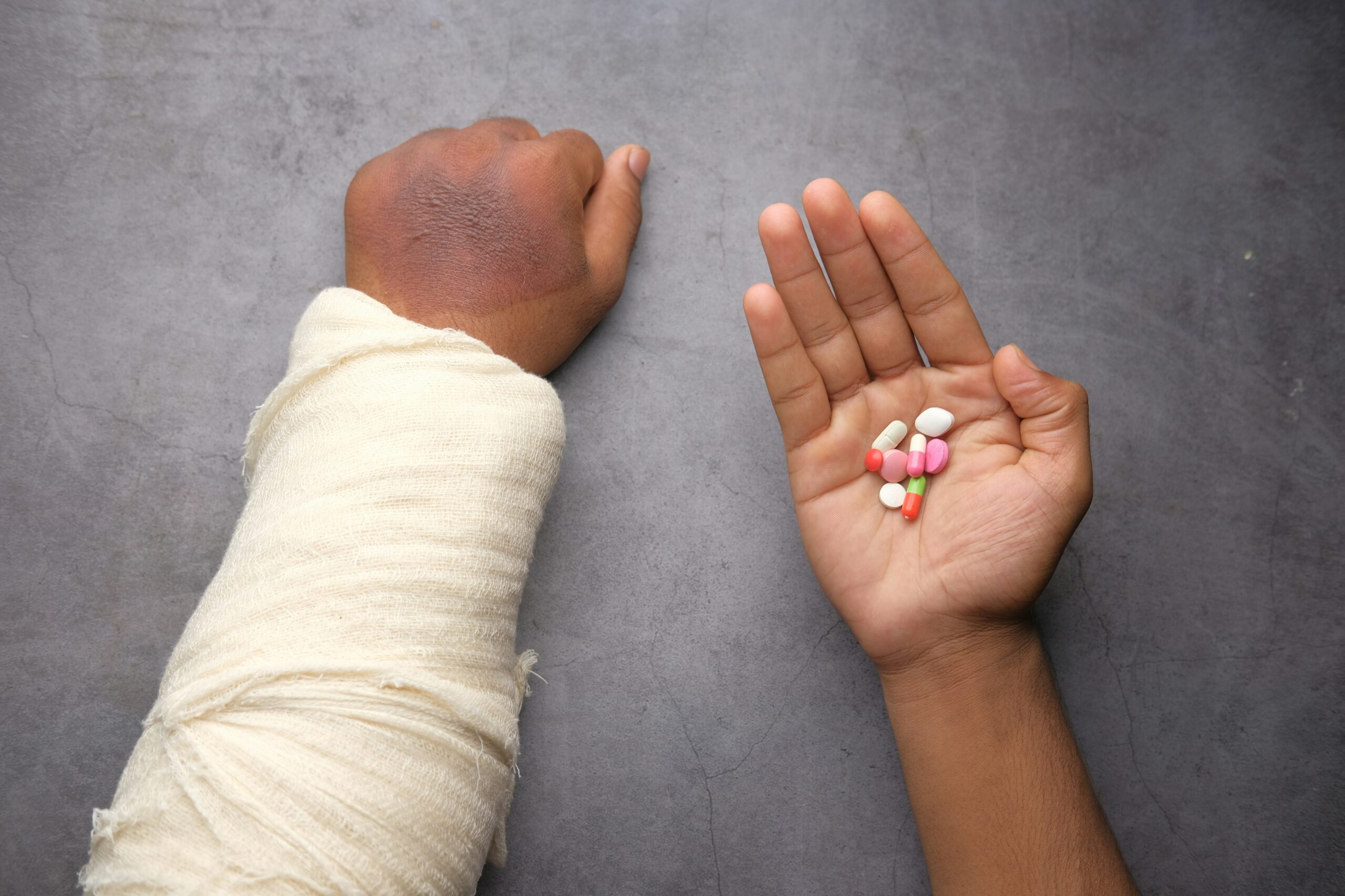 Bodily Injury